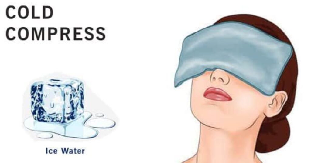 Natural Remedies for Headache Cold Compress